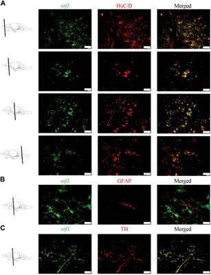 Neuroprotective effects of Neurotrophin-3 in MPTP-induced zebrafish Parkinson’s disease model